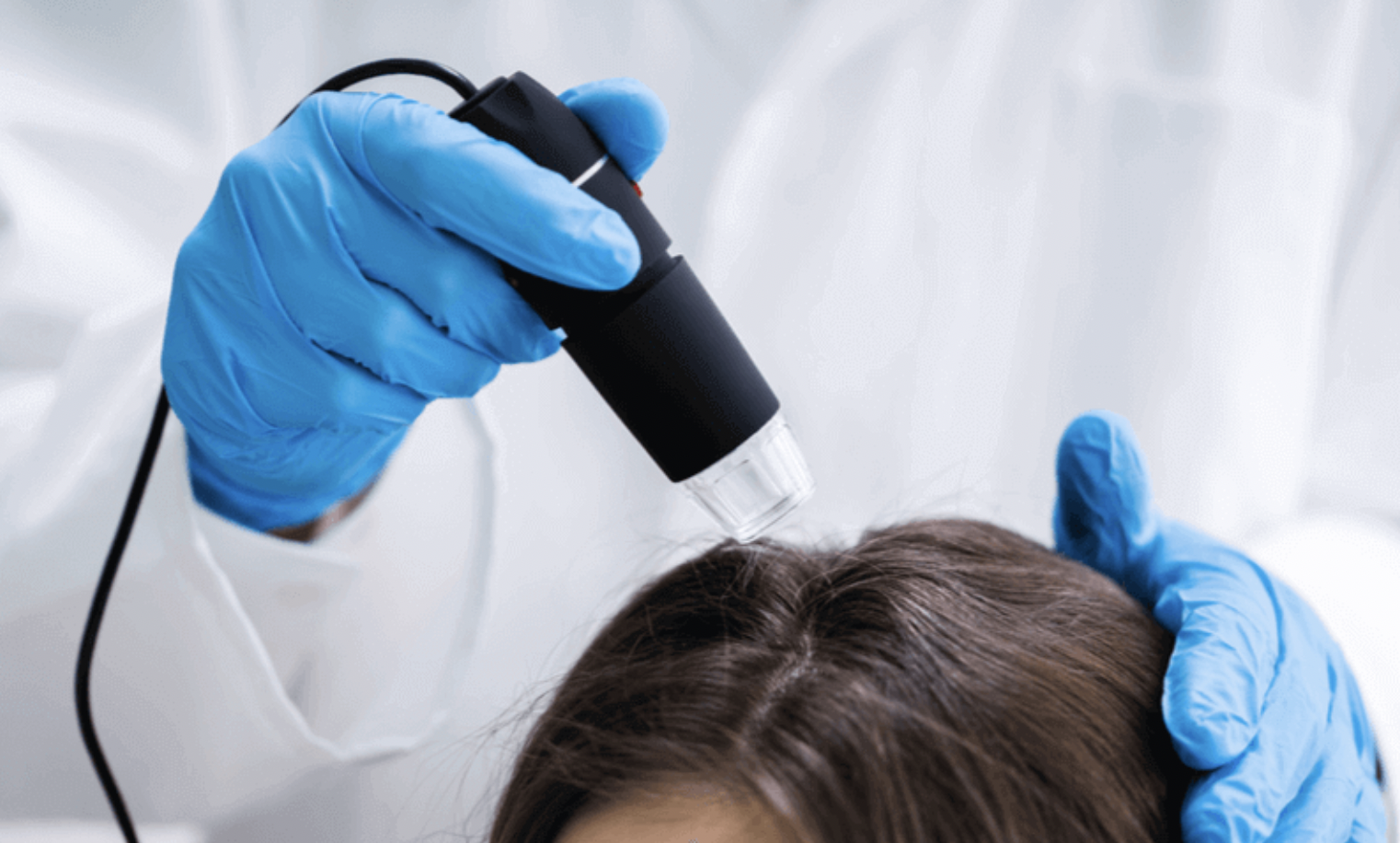 Exploring the Benefits of Laser Therapy for Hair Loss