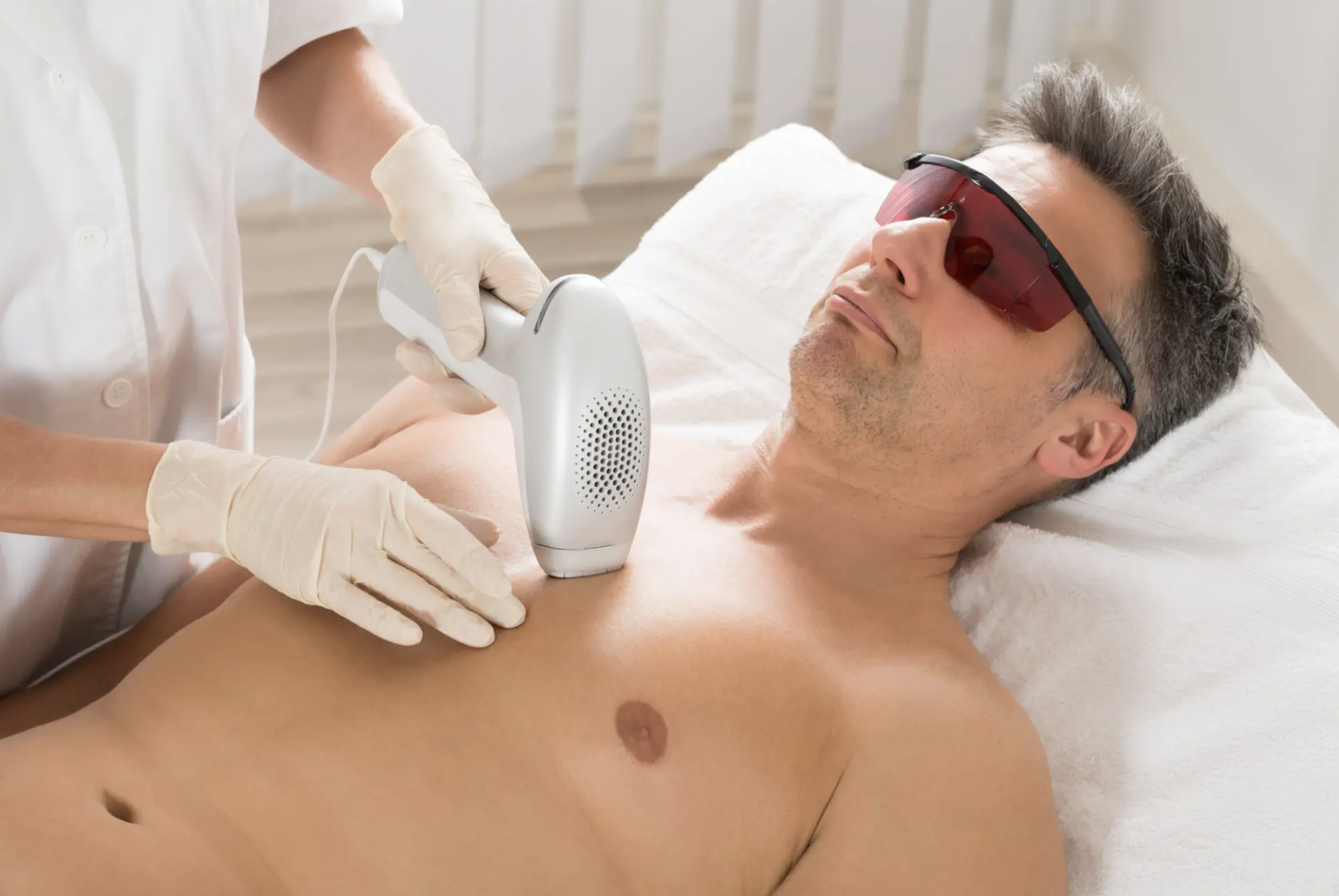 The Top Benefits of Laser Hair Removal in London